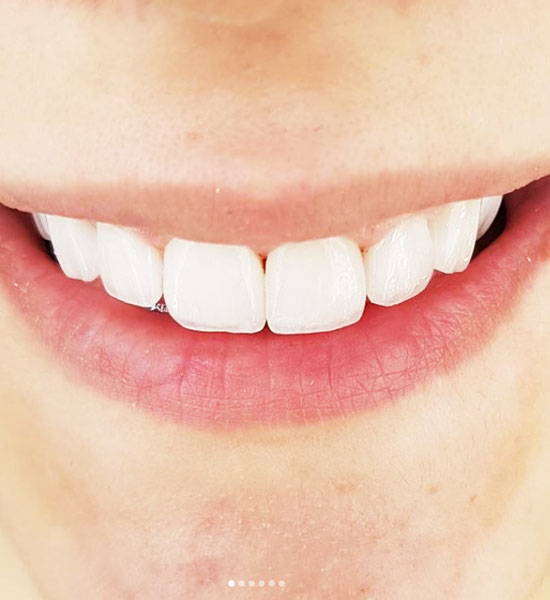 Doğru bir planlama Gülüş tasarımı